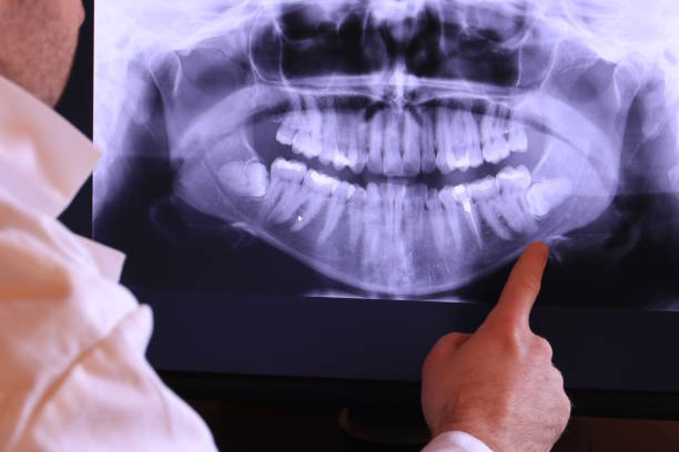Best Emergency Dental Care for Broken or Chipped Teeth in Dunlap, IA